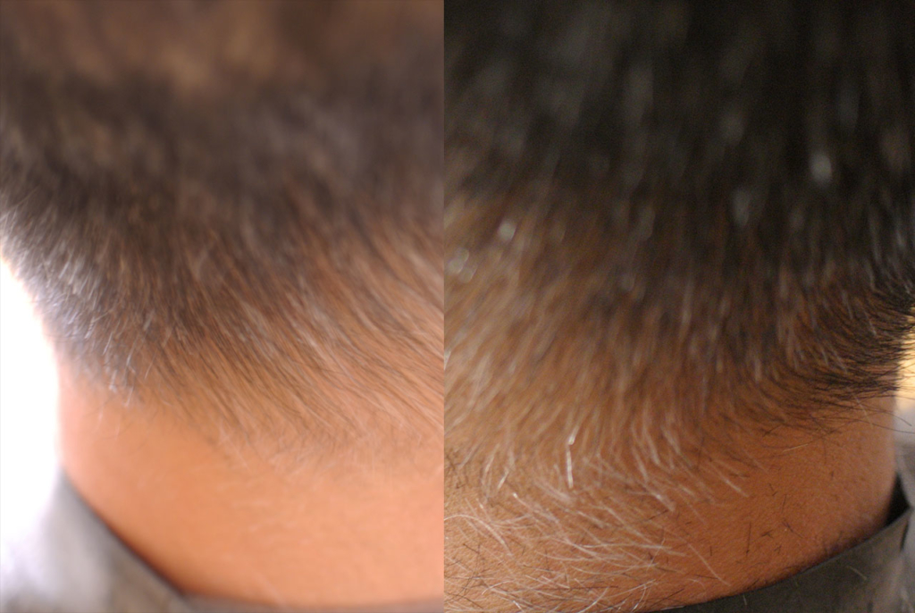 おうちで散髪(襟足編)